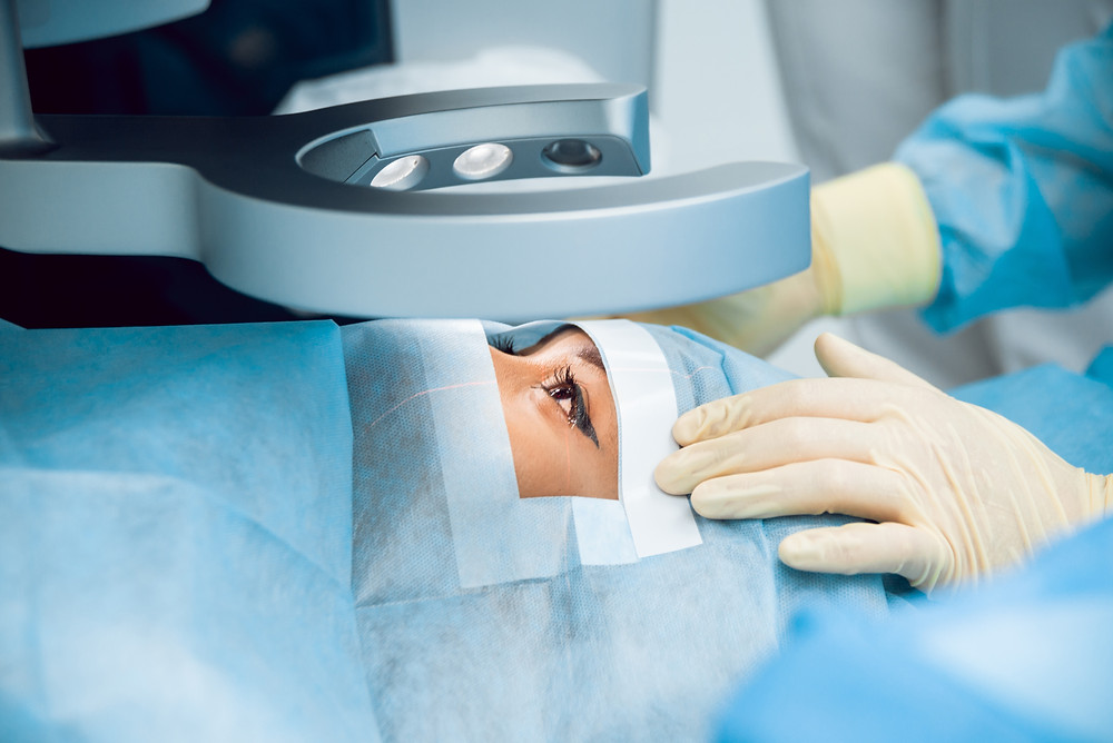 7 Things That Qualifies You for LASIK Eye Surgery
